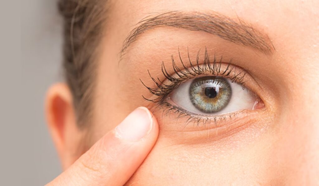 How To Fix The Problem Of Under-Eye Bags